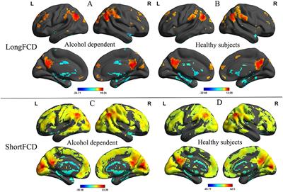 Ventral Visual Pathway-Cerebellar Circuit Deficits in Alcohol Dependence: Long- and Short-Range Functional Connectivity Density Study